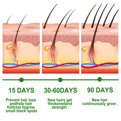 Eelhoe Rosemary Hair Growth Oil