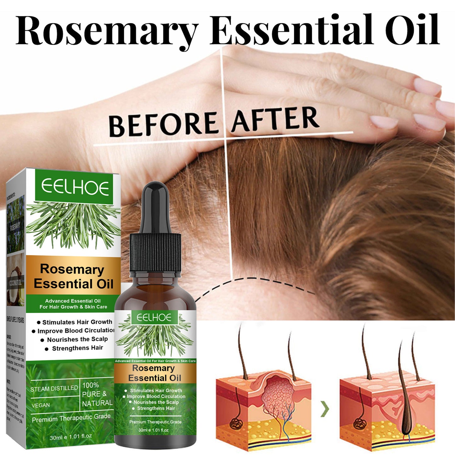 Eelhoe Rosemary Hair Growth Oil